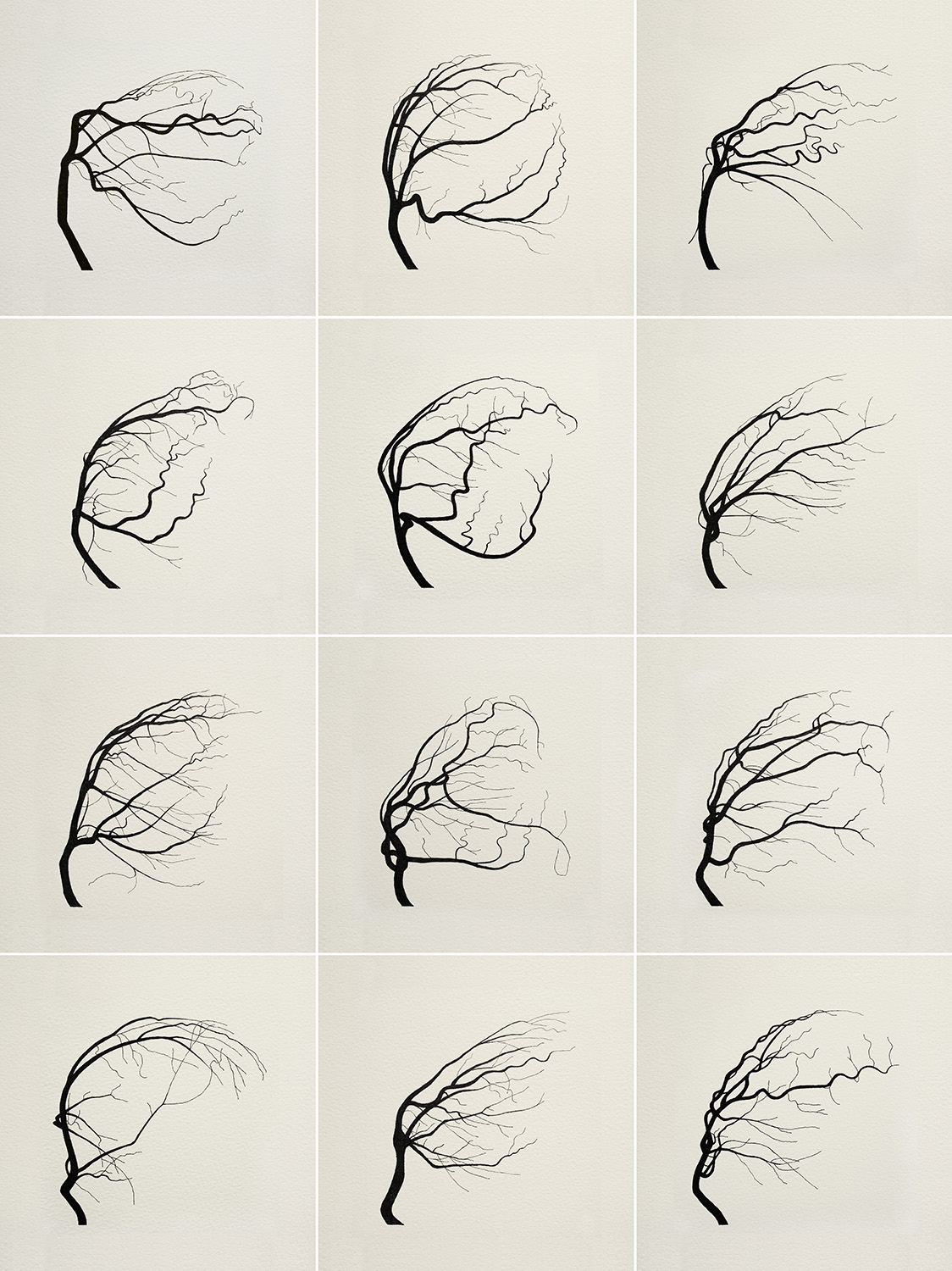 oona-culley-coronary-trees-prints